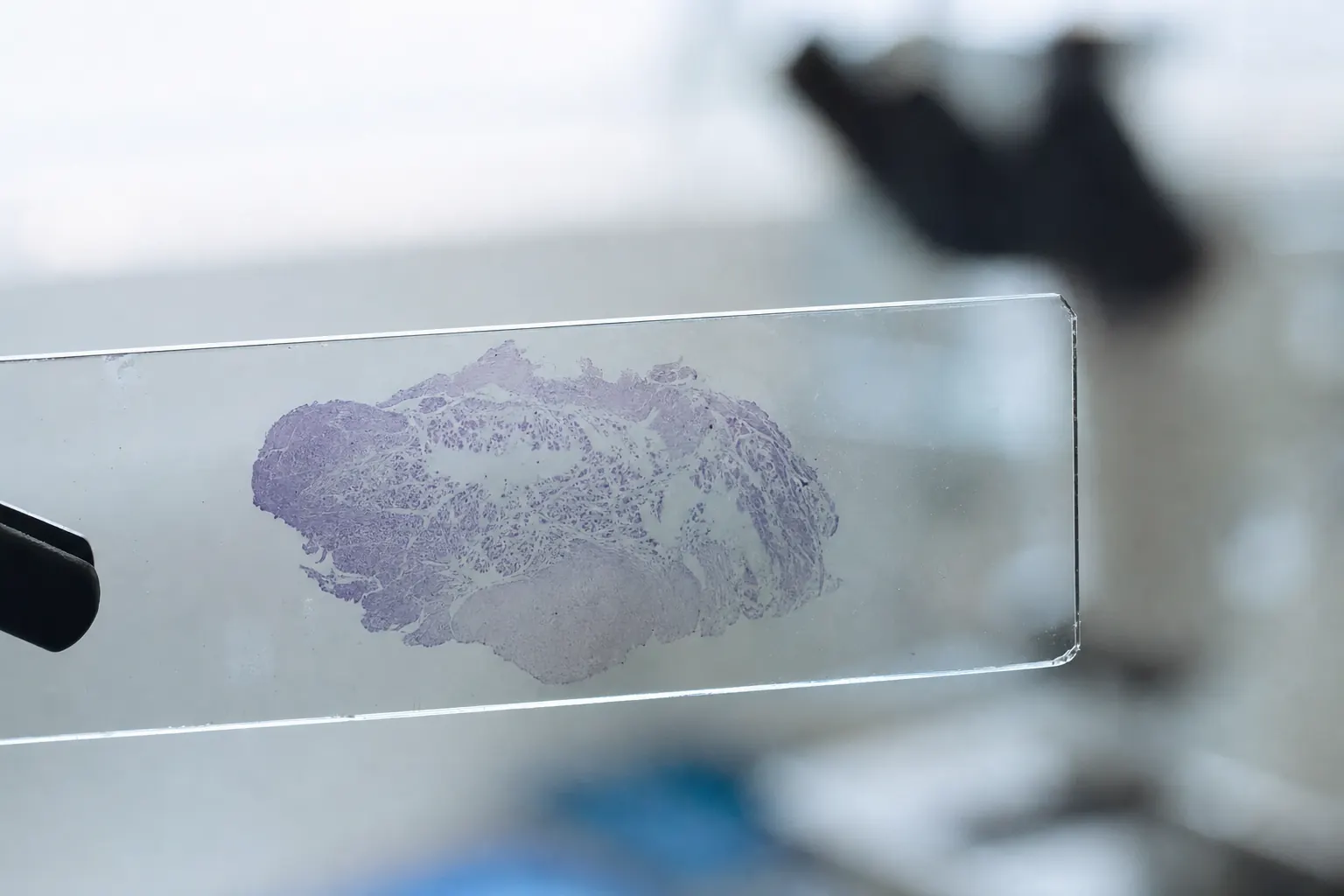 Weefselpreparaat op een objectglaasje tegen het daglicht, met een microscoop op de achtergrond